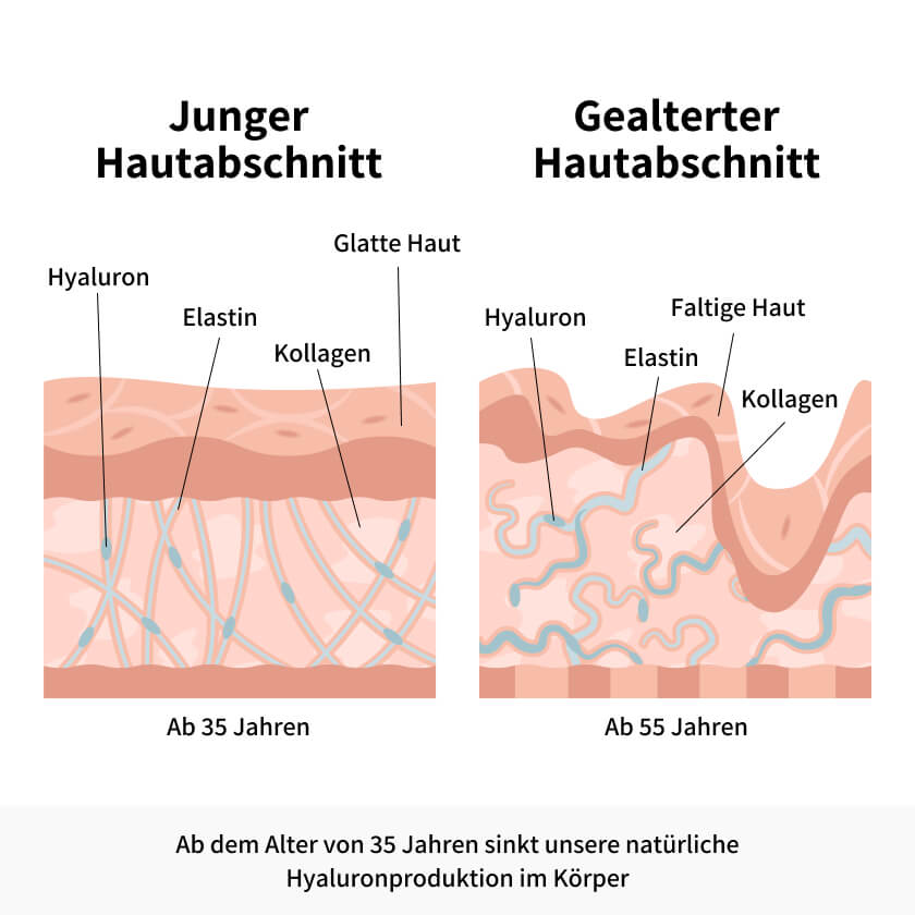 HYALURONSERUM SOARING STREAM (Angebot)